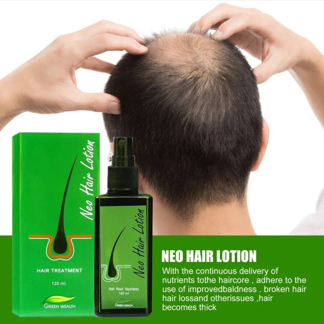 NEO Hair Regrowth Lotion | Hair Loss, Thinning & Baldness Treatment Hair Oil