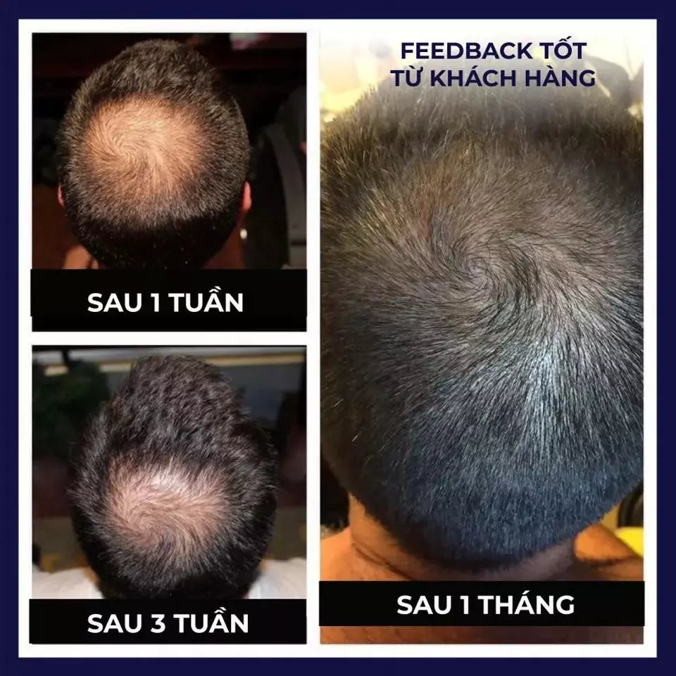 FEG Organic Anti-Hair Loss Hair Growth Oil 50ml | Thicker, Longer & Stronger Hair Treatment