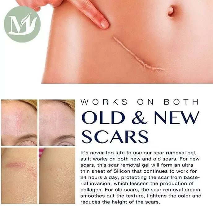 Silicone Scar Gel β Stretch Marks & Surgery Scar Removal Cream | Advanced Skin Care Treatment