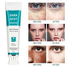 iBeaLee Whitening Freckle Cream 20ml – Pack of 12 | Dark Spot Remover, Melasma & Anti-Aging Skincare
