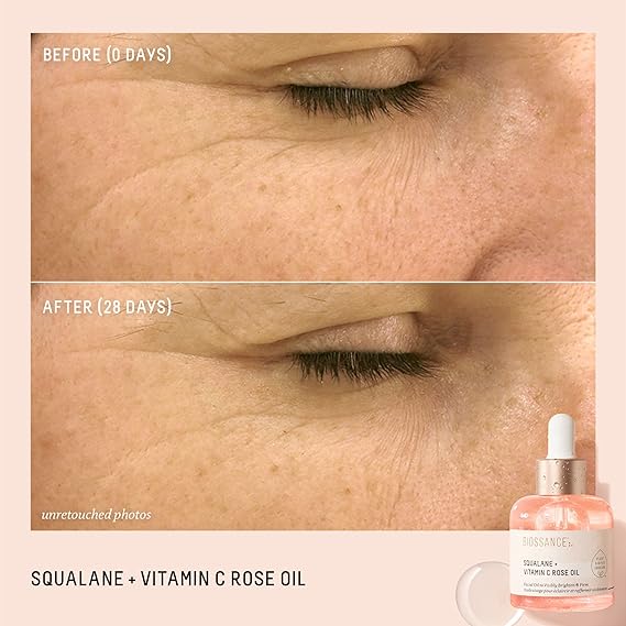 Biossance Squalane + Vitamin C Rose Oil | Hydrating & Brightening Facial Oil